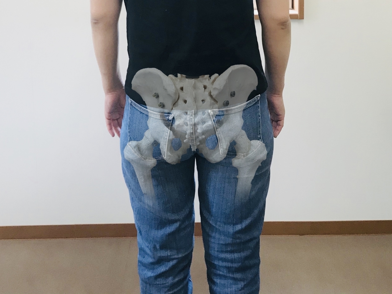 骨格が歪んだ例